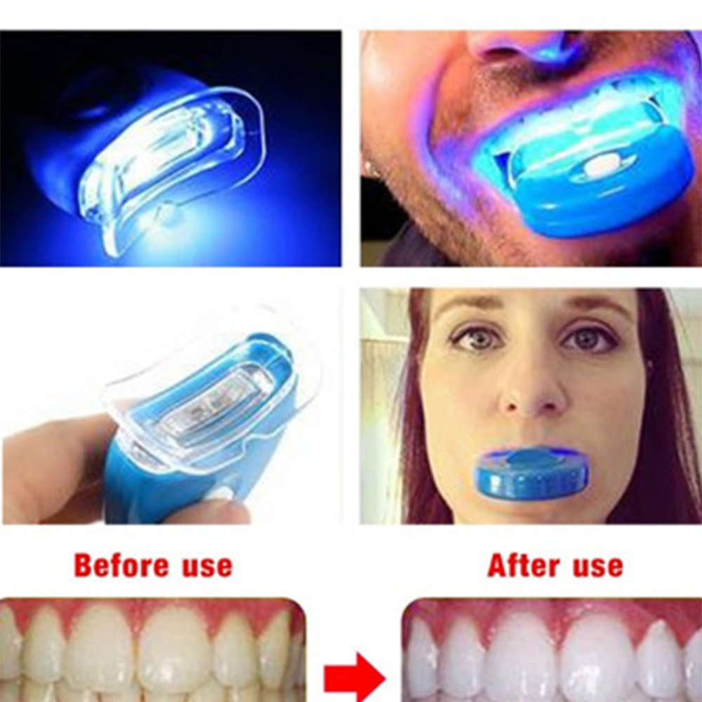 Teeth Whitening Laser Treatment - LED blanchiment des dents lumière blanchissant