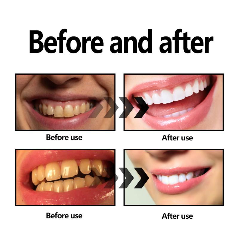 Poudre de blanchiment des dent - Teeth Whitening Baking Soda avis et prix