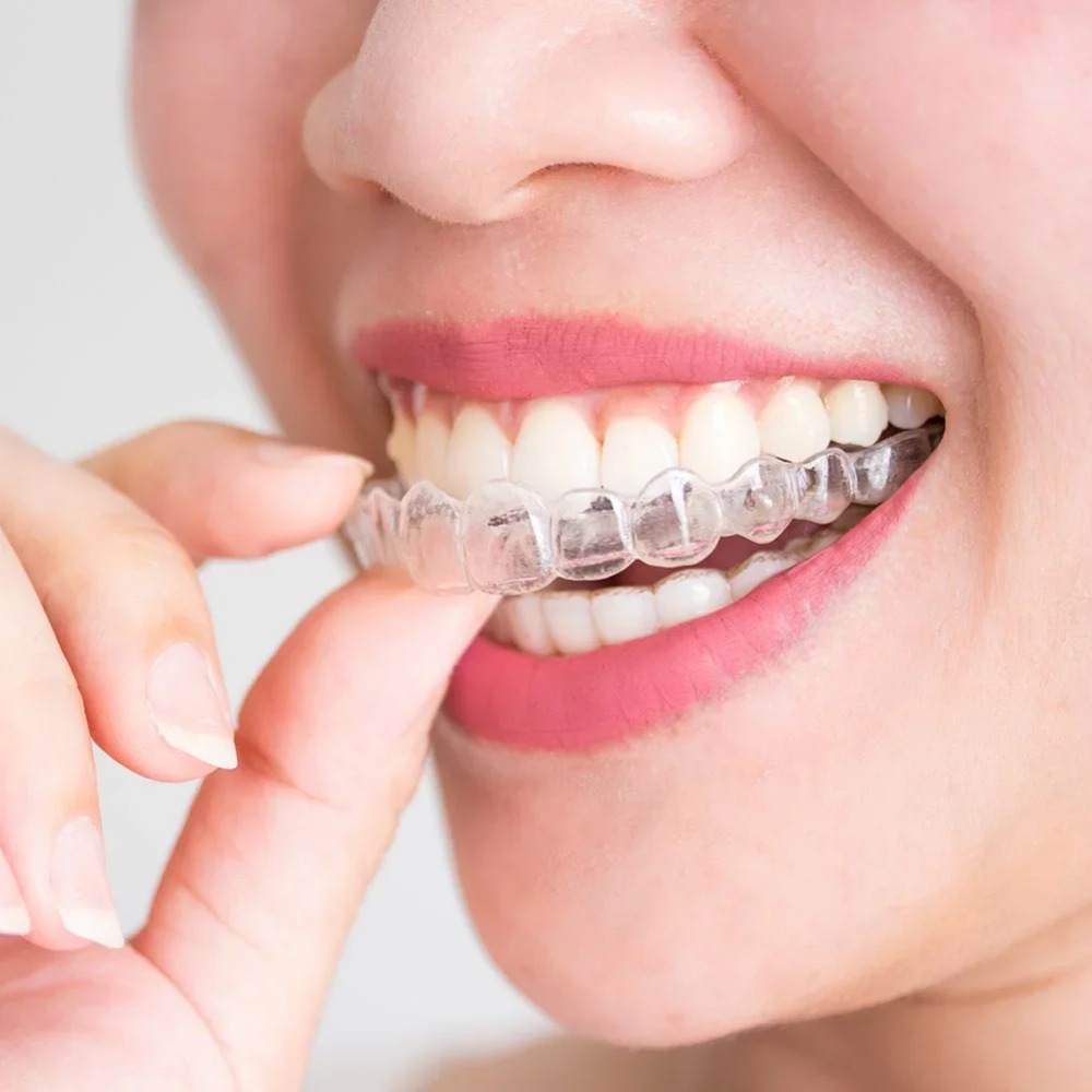 1-4 Pièces Gouttière buccale d - Dental Guard Night avis et prix