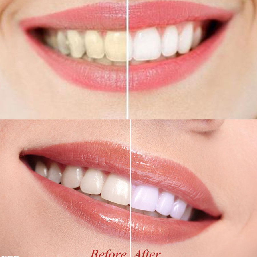 Poudre de charbon de bambou po - Teeth Whitening Quotes avis et prix