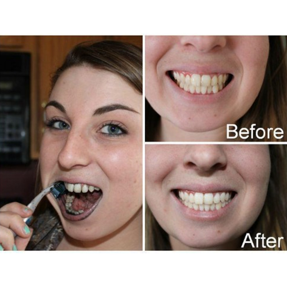 Poudre de charbon de bambou po - Teeth Whitening Quotes avis et prix