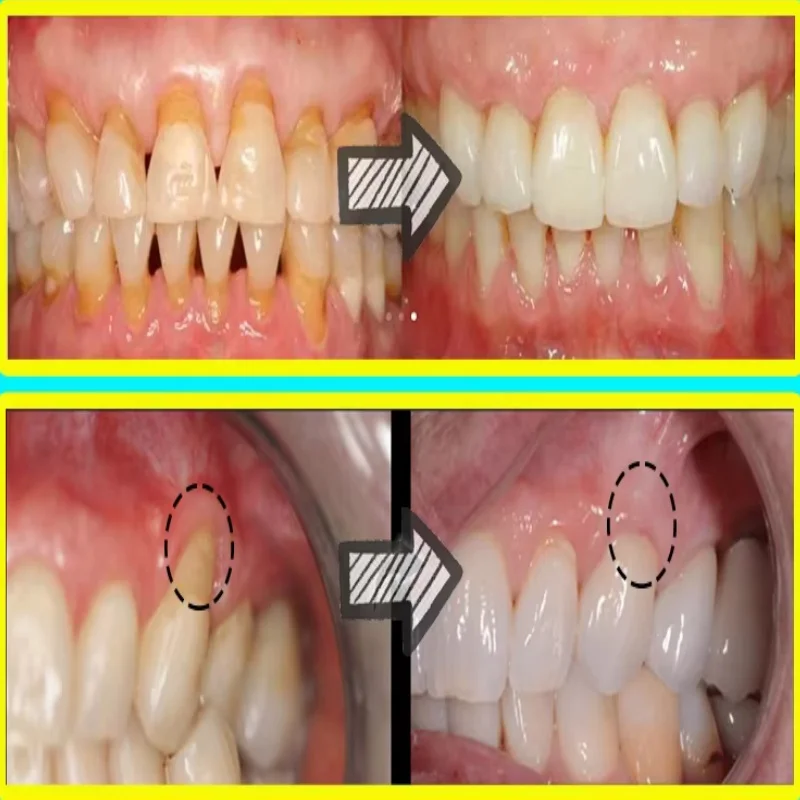 Sérum de réparation rapide des - Teeth Whitening Baking Soda avis et prix