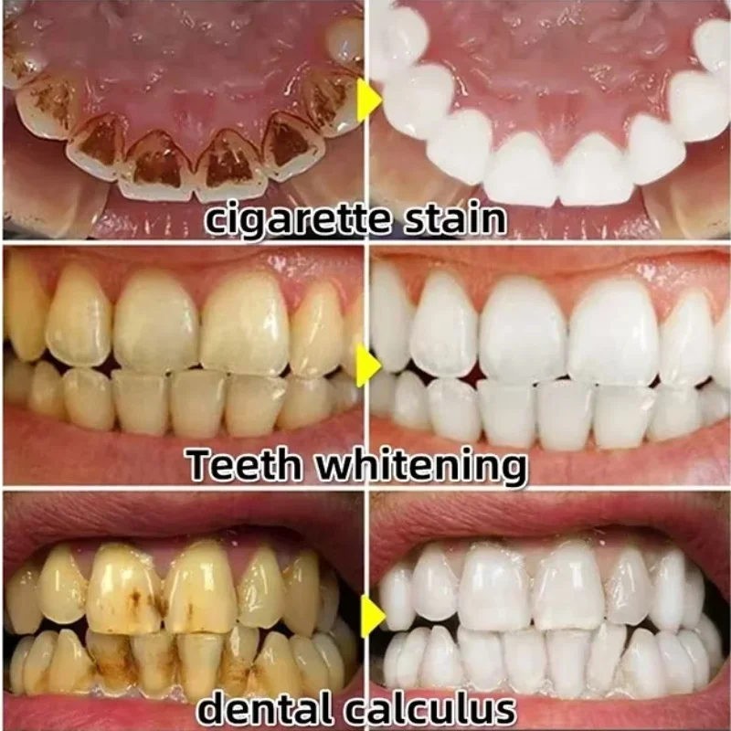 Sérum de réparation rapide des - Teeth Whitening Baking Soda avis et prix
