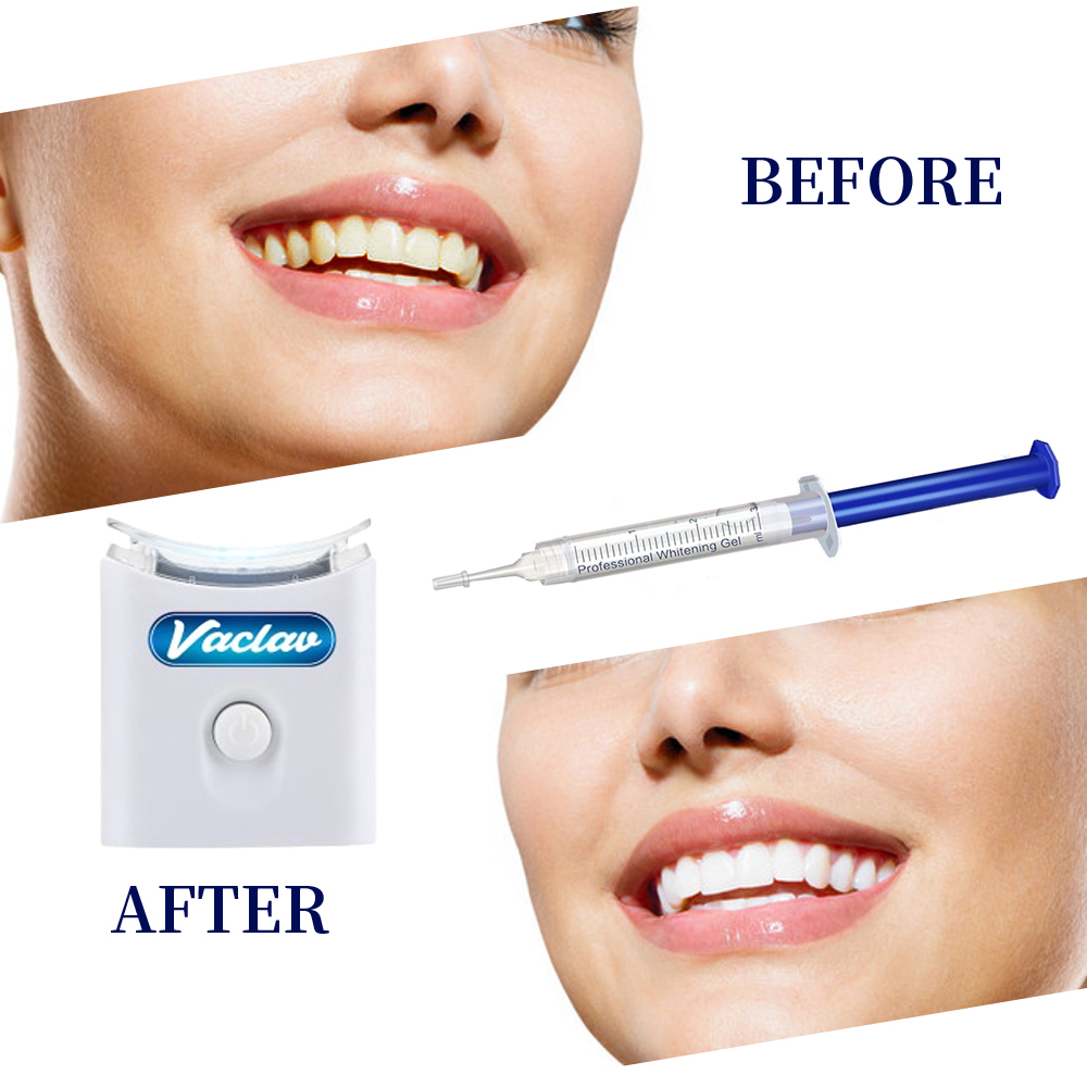 Seringue de Gel de blanchiment - Teeth Whitening Baking Soda avis et prix