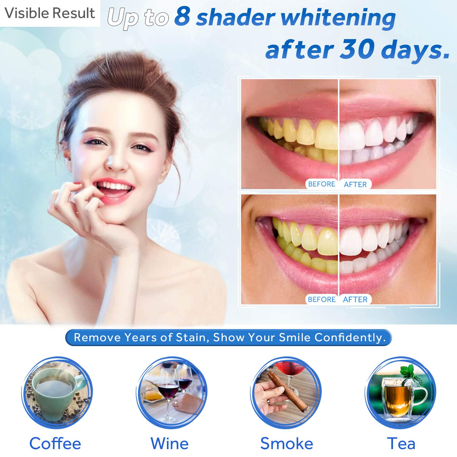 Gel de blanchiment des dents r - Colgate Whitening Teeth avis et prix