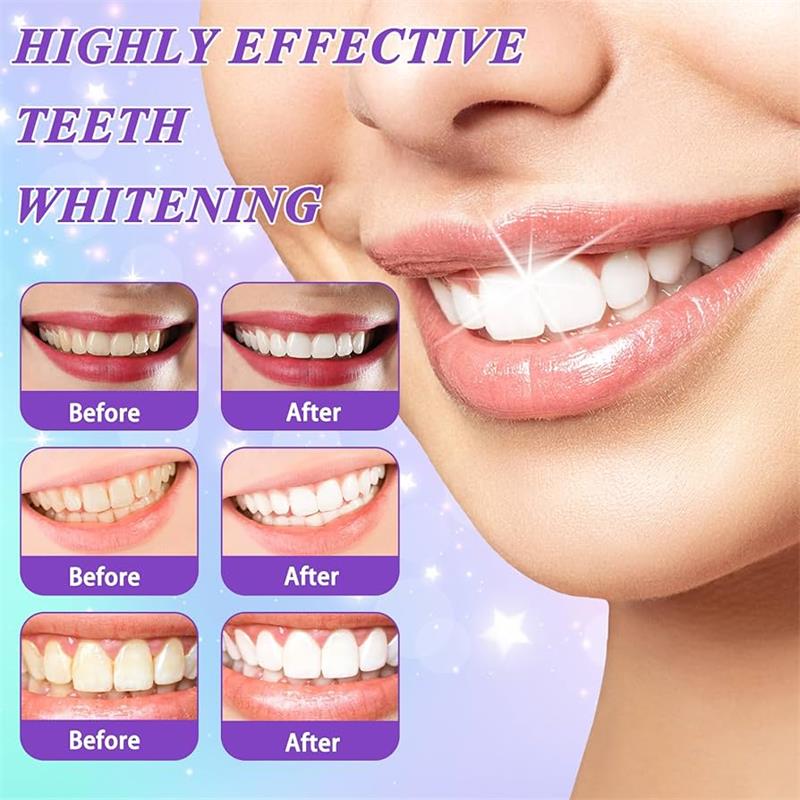 Mousse dentifrice blanchissant - Teeth Whitening That Works avis et prix