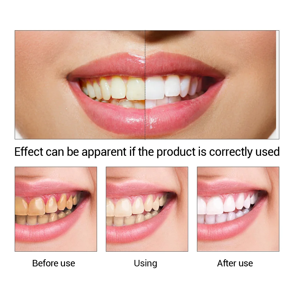 FTEENPLY poudre d'essence de b - Teeth Whitening Quotes avis et prix