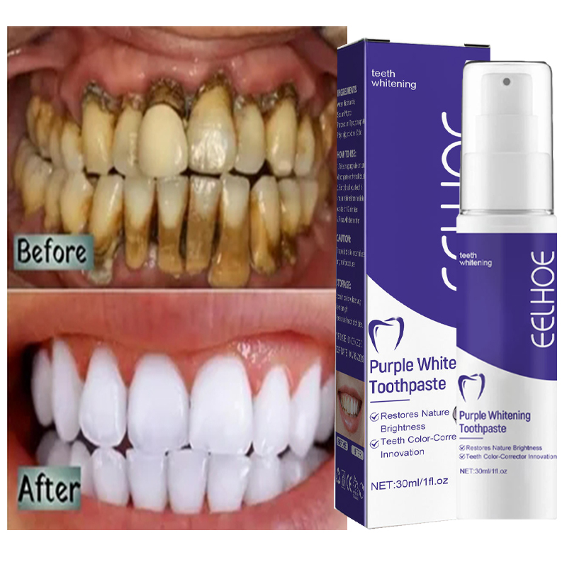Dentifrice blanchissant pour l - Teeth Whitening In Korea avis et prix