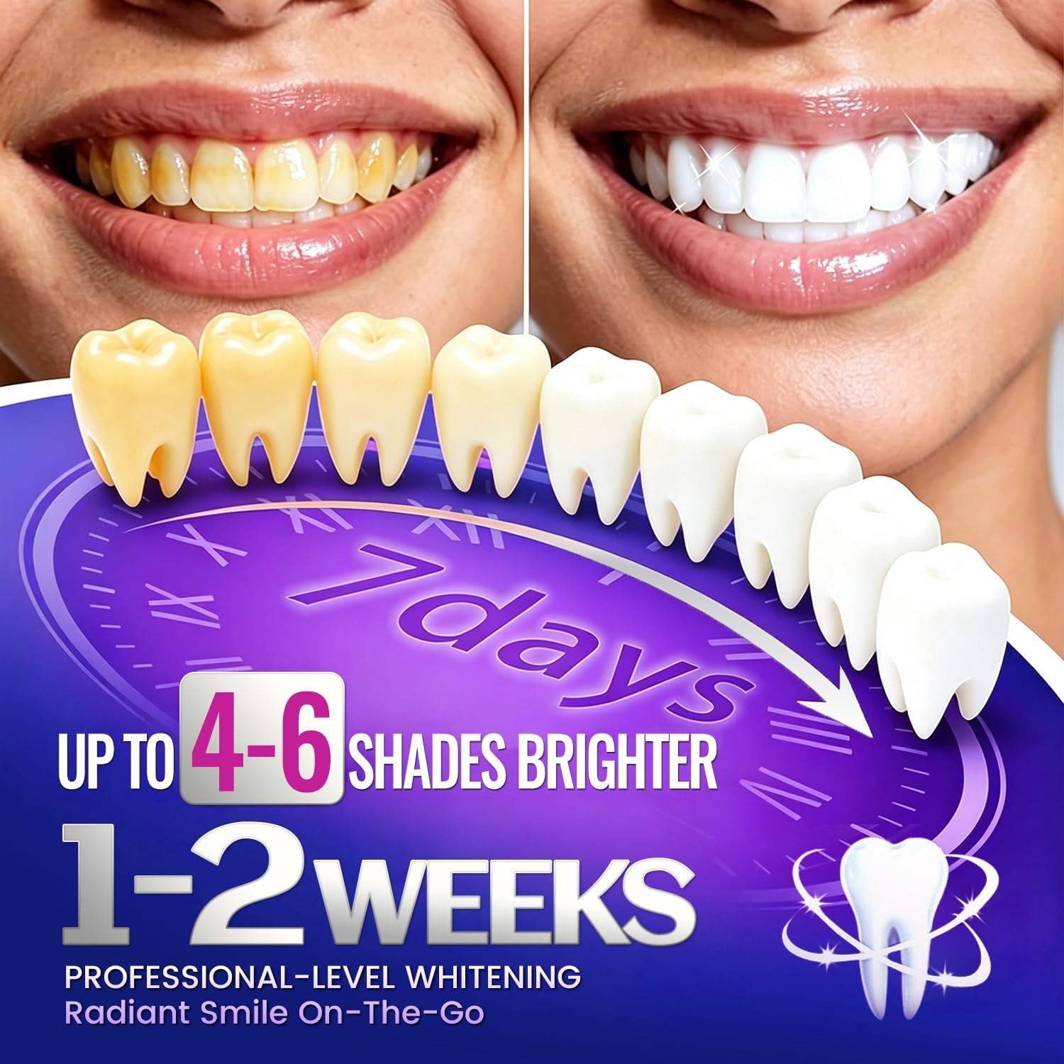1/7 paires de bandes blanchiss - Teeth Whitening Retainer avis et prix