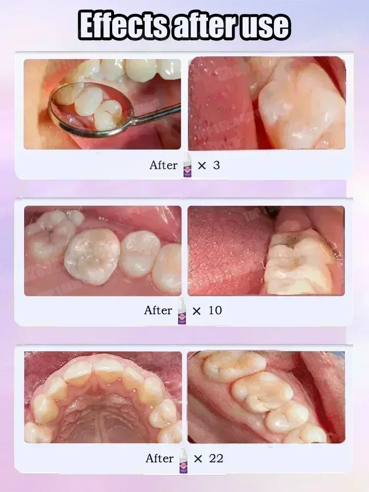 Offres spéciales Best-seller,  - Teeth Whitening That Works avis et prix