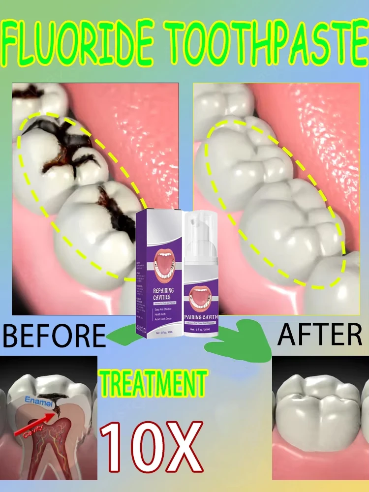 Répare les cavités scientifiqu - Teeth Whitening That Works avis et prix