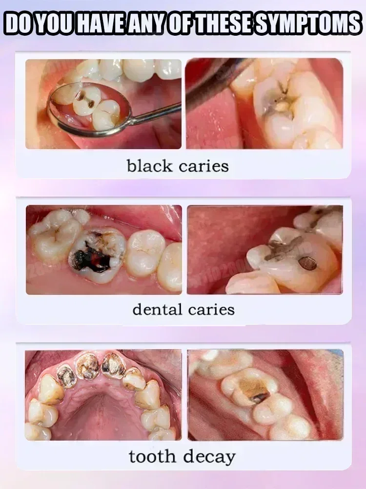 Répare les cavités scientifiqu - Teeth Whitening That Works avis et prix