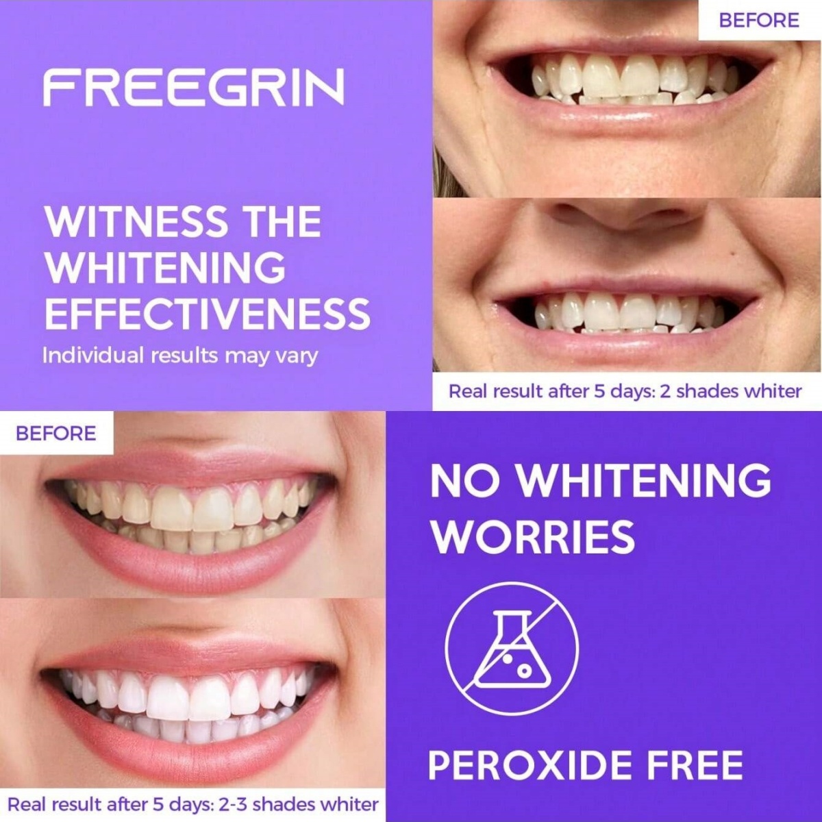 Autocollants de blanchiment de - Teeth Whitening Retainer avis et prix